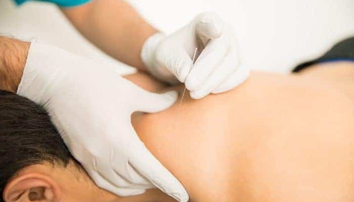 VU21879 Dry Needling Course VU21879 Dry Needling Course